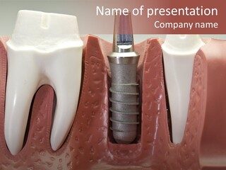 Close Up Dentist Denture PowerPoint Template