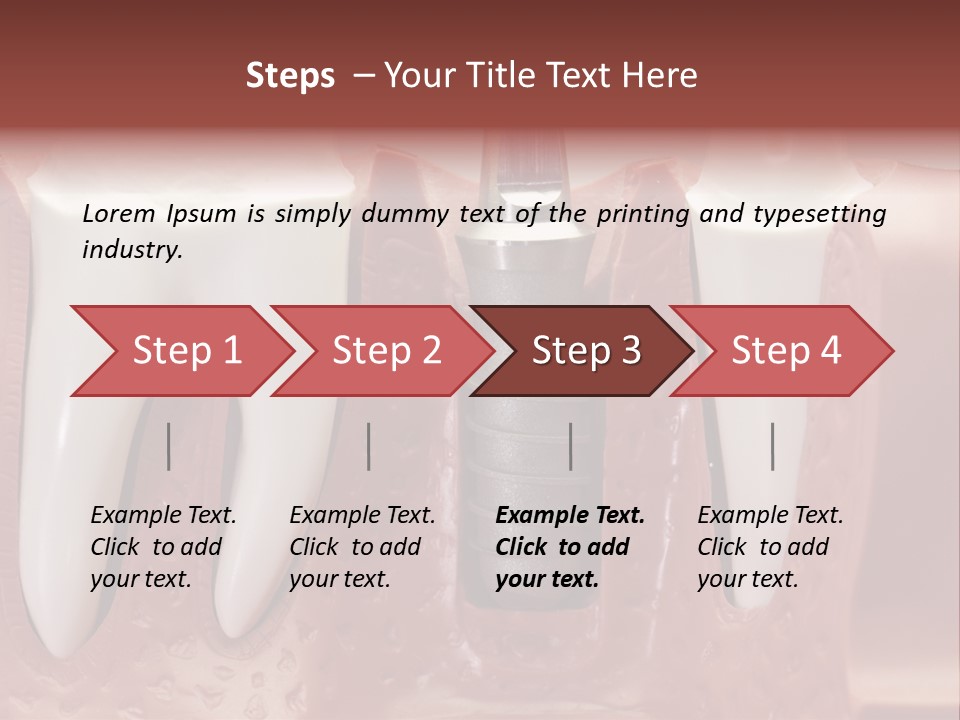 Close Up Dentist Denture PowerPoint Template