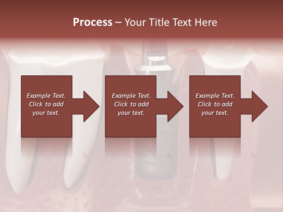 Close Up Dentist Denture PowerPoint Template