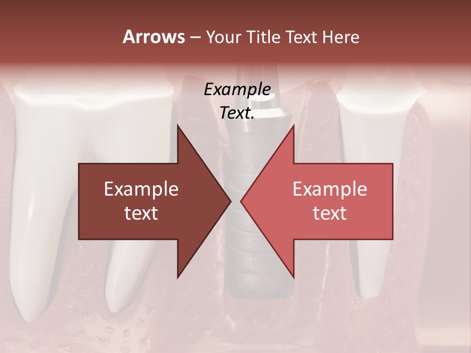 Close Up Dentist Denture PowerPoint Template