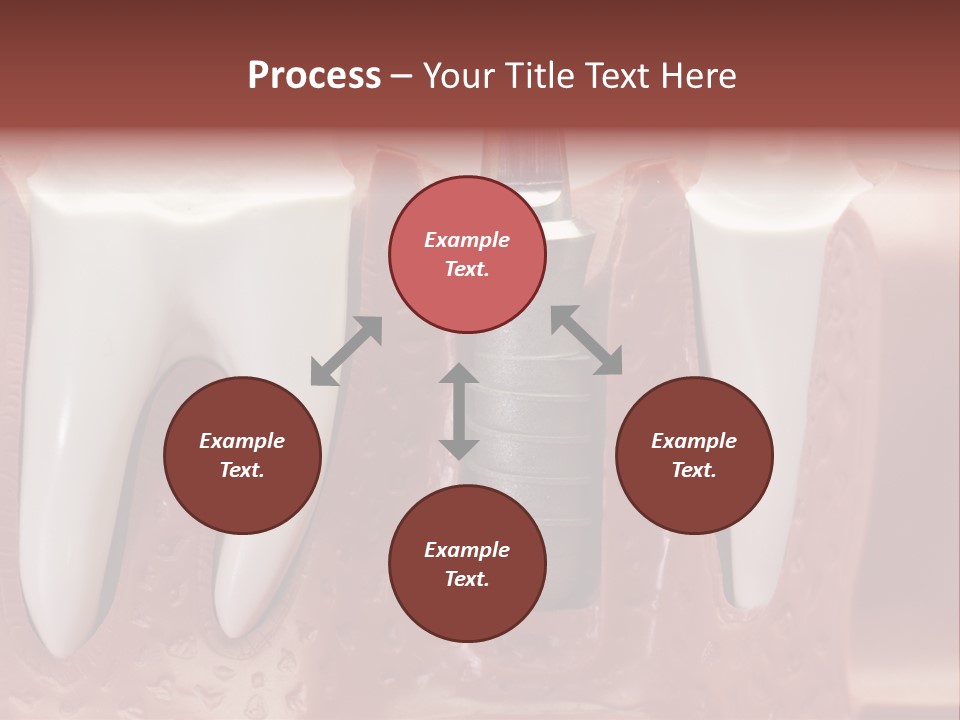 Close Up Dentist Denture PowerPoint Template