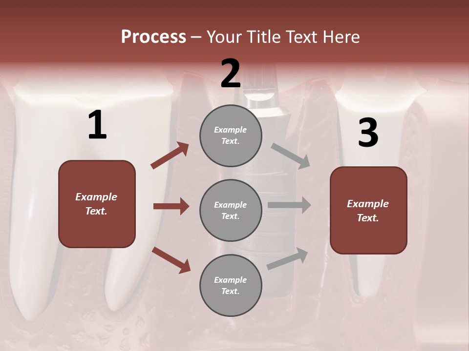 Close Up Dentist Denture PowerPoint Template