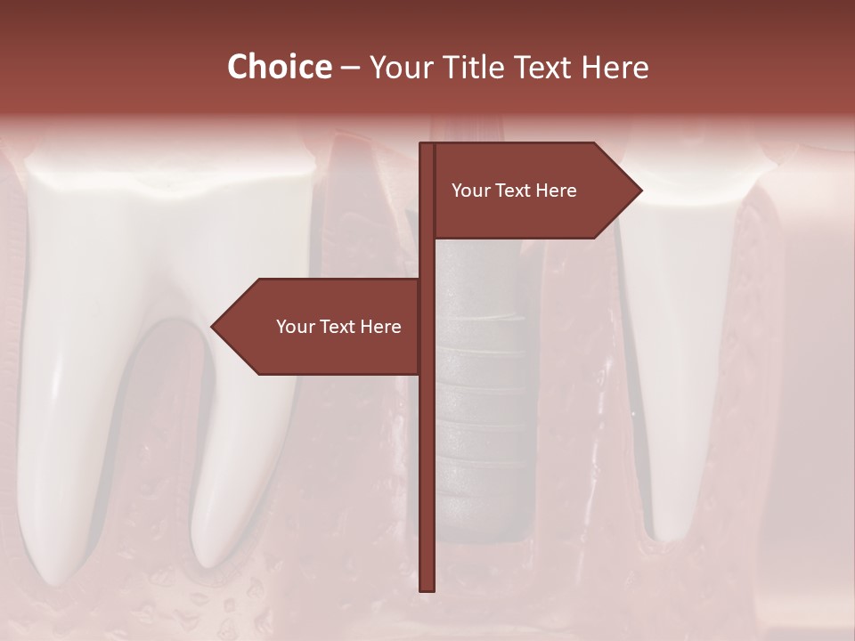 Close Up Dentist Denture PowerPoint Template