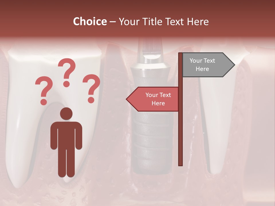 Close Up Dentist Denture PowerPoint Template