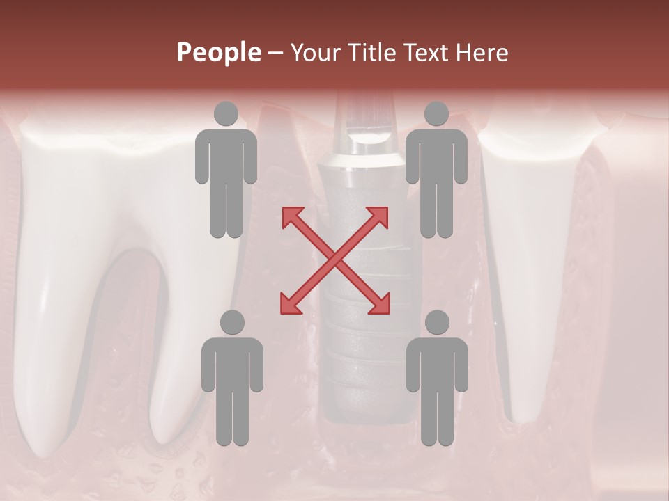 Close Up Dentist Denture PowerPoint Template