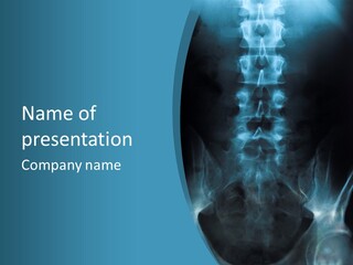 Body Diagnosis Vertebra PowerPoint Template