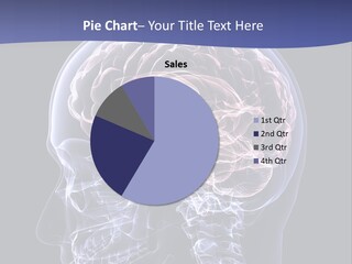 X Ray Man Bone PowerPoint Template