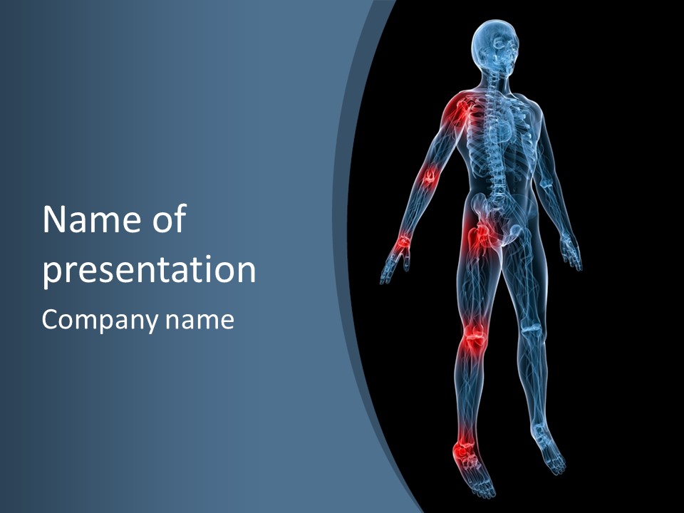 Skeleton Spine Osteoporosis PowerPoint Template