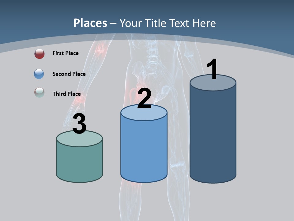 Skeleton Spine Osteoporosis PowerPoint Template