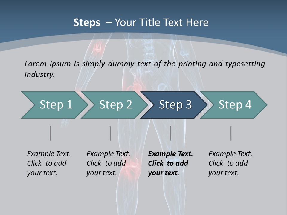 Skeleton Spine Osteoporosis PowerPoint Template