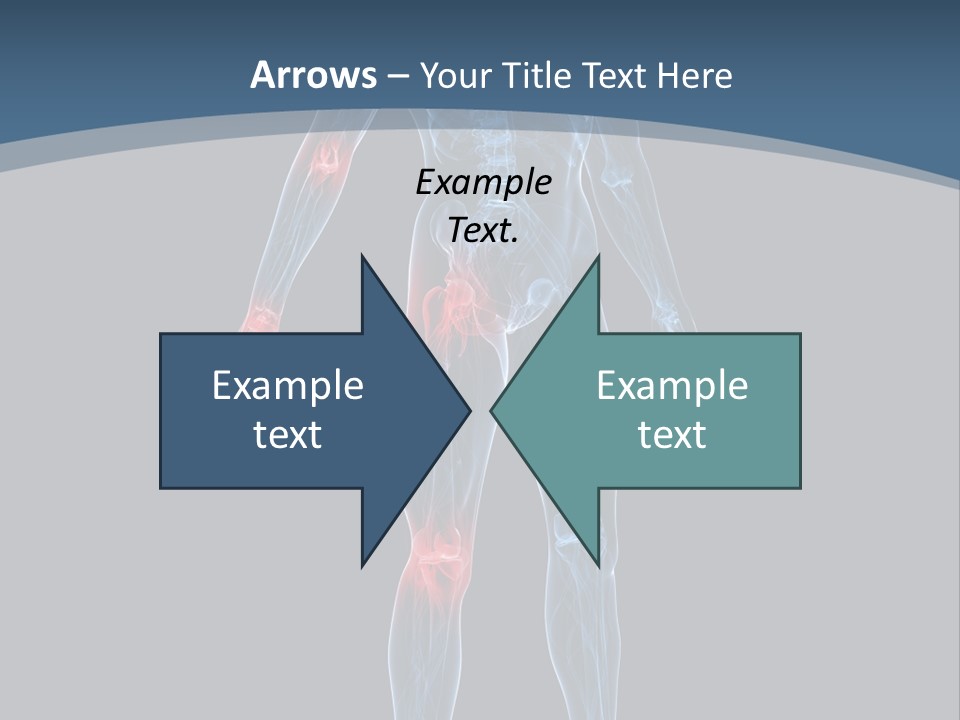 Skeleton Spine Osteoporosis PowerPoint Template