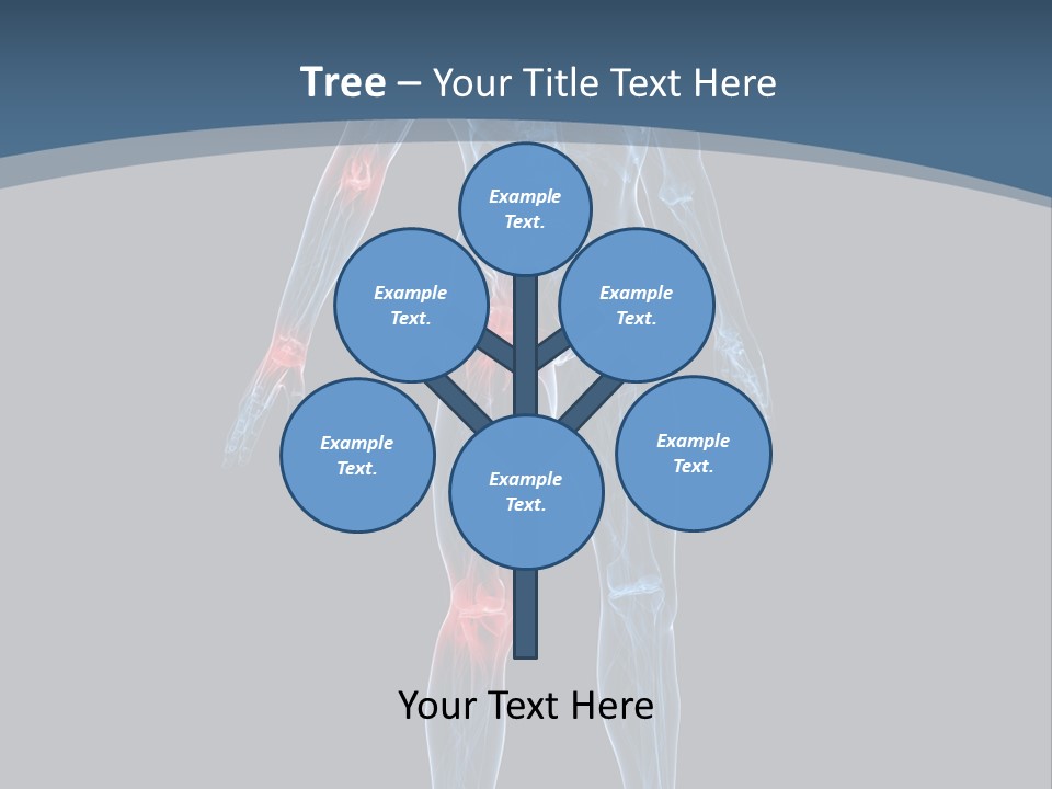 Skeleton Spine Osteoporosis PowerPoint Template