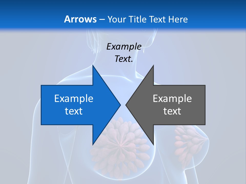 A Woman With Breast Cancer Powerpoint Presentation PowerPoint Template