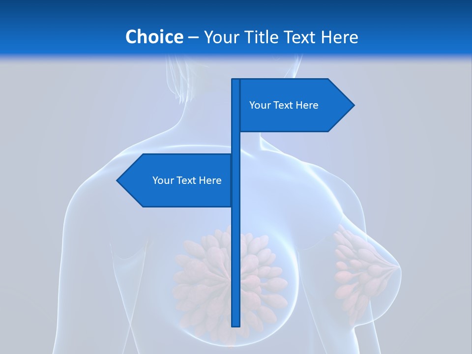 A Woman With Breast Cancer Powerpoint Presentation PowerPoint Template