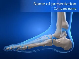 Pain Chondral Ankle PowerPoint Template