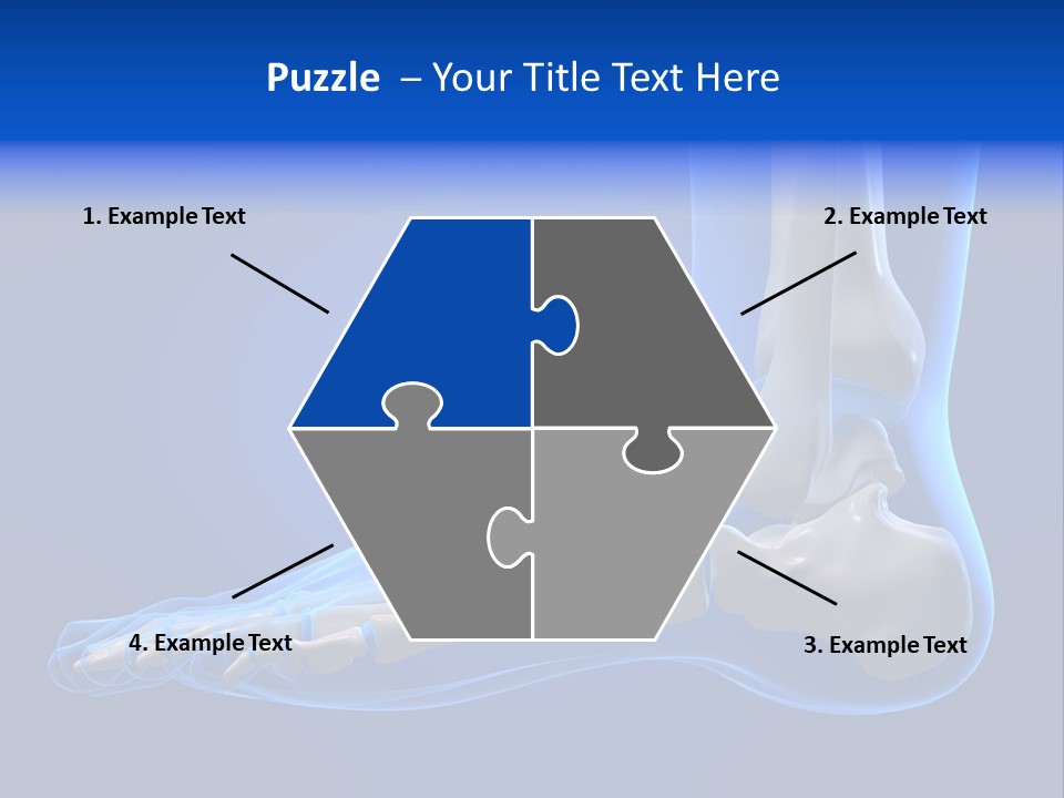 Pain Chondral Ankle PowerPoint Template