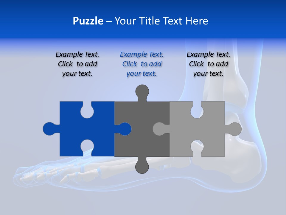 Pain Chondral Ankle PowerPoint Template