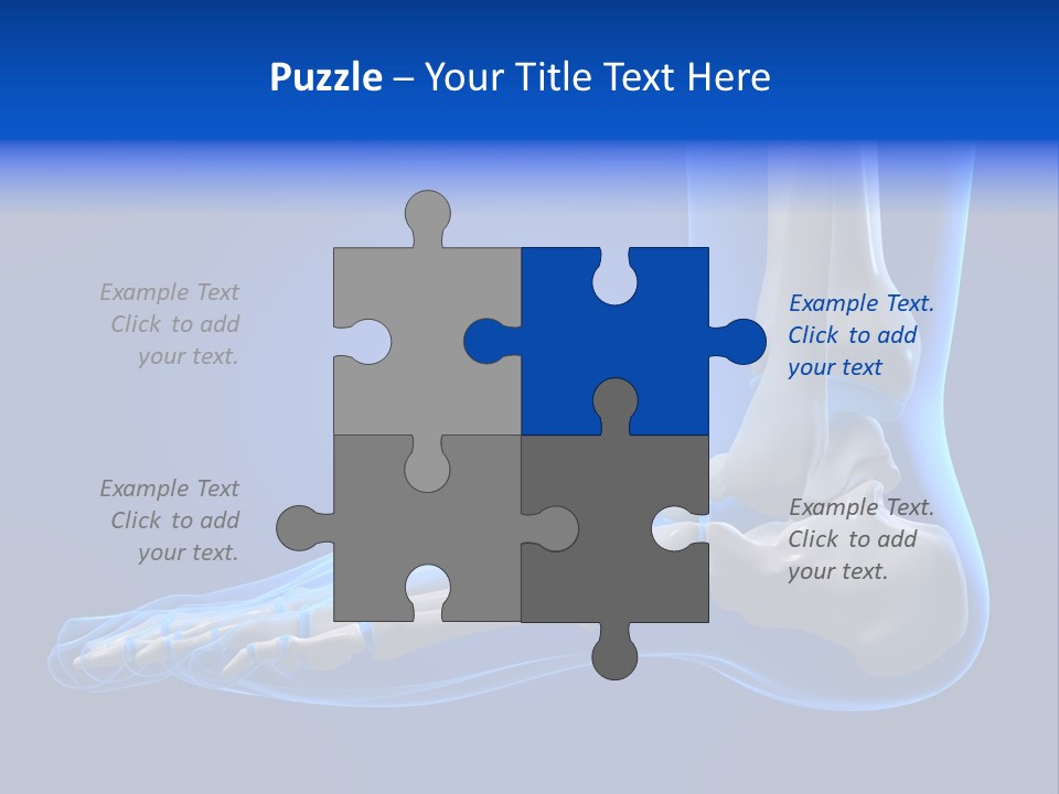 Pain Chondral Ankle PowerPoint Template