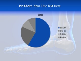 Pain Chondral Ankle PowerPoint Template