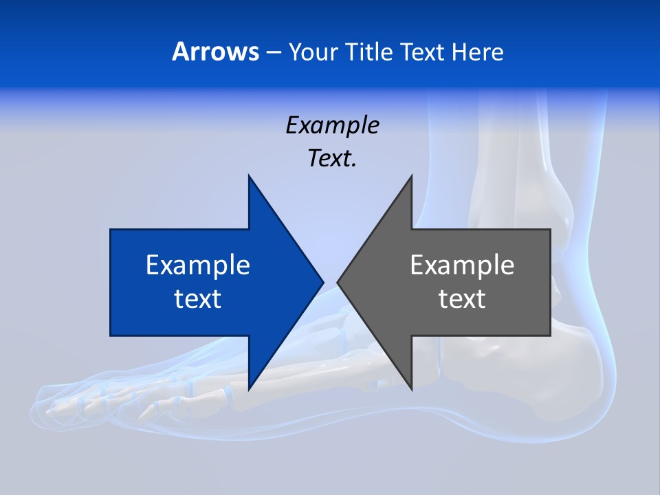 Pain Chondral Ankle PowerPoint Template
