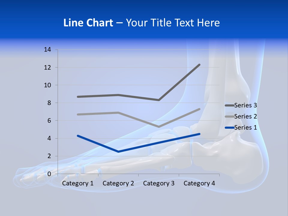 Pain Chondral Ankle PowerPoint Template