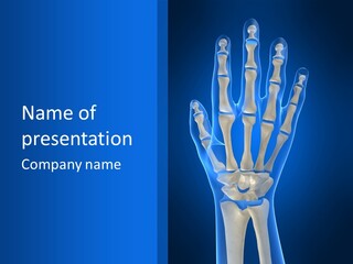 Joint Phalanx Bones PowerPoint Template