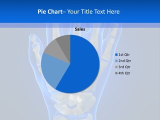 Joint Phalanx Bones PowerPoint Template