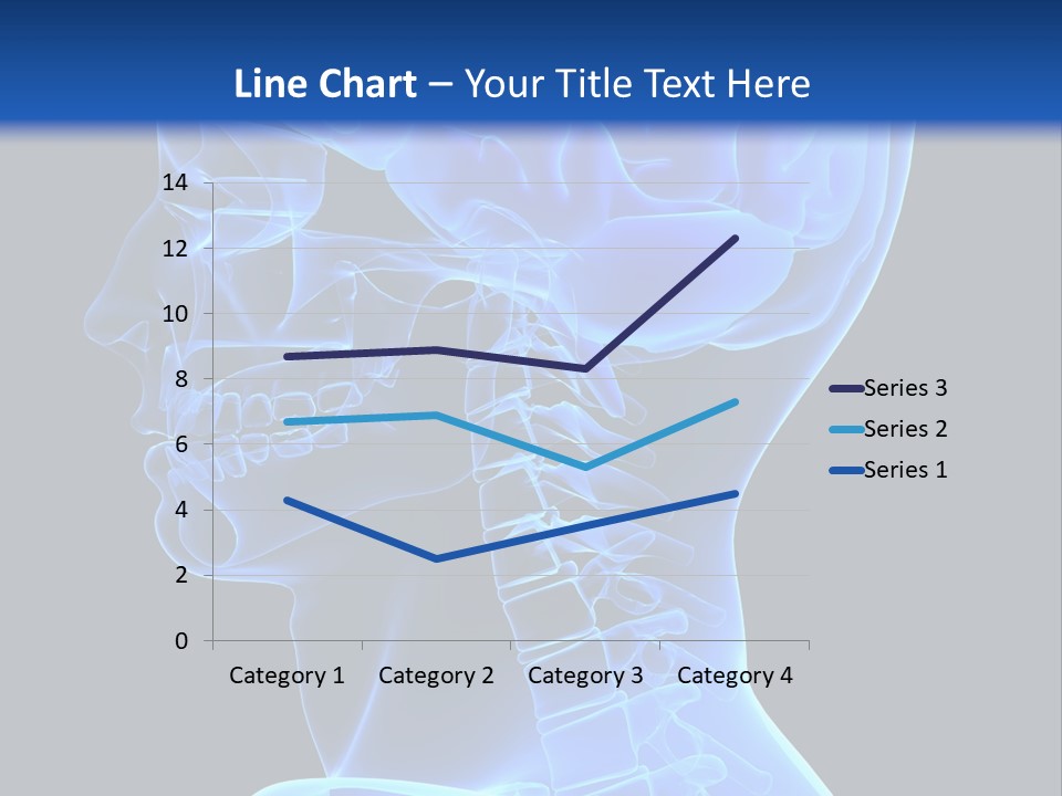 A Skeleton With A Blue Background Is Shown In This Powerpoint Presentation PowerPoint Template