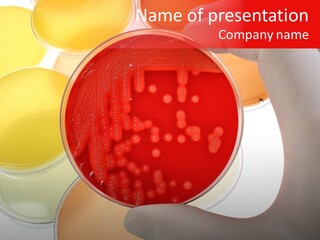 Diagnostics Bacteria Disease PowerPoint Template