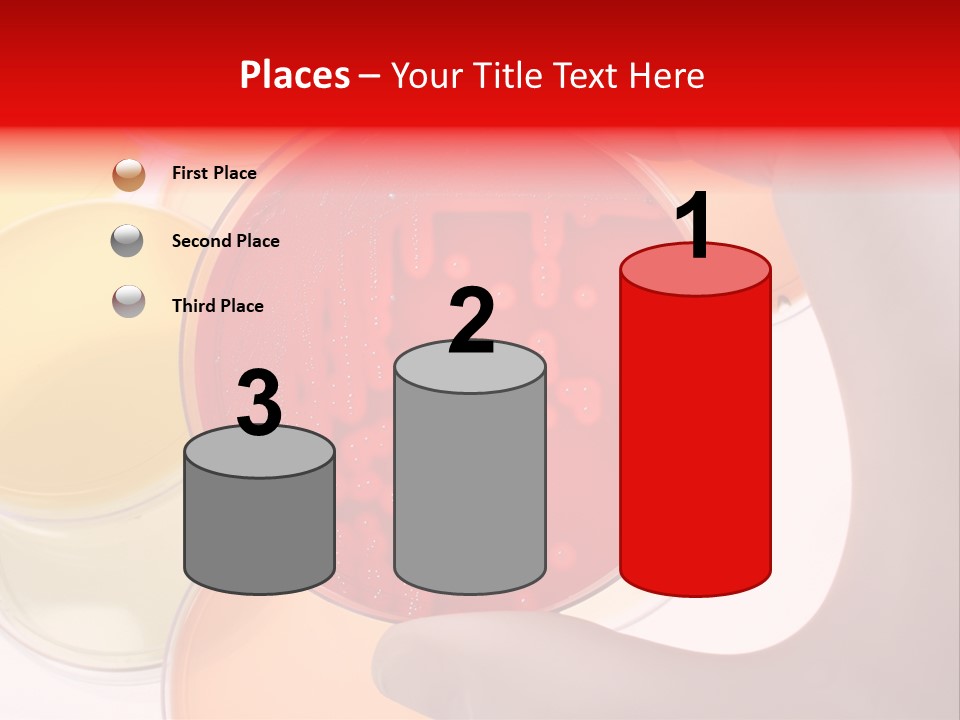 Diagnostics Bacteria Disease PowerPoint Template