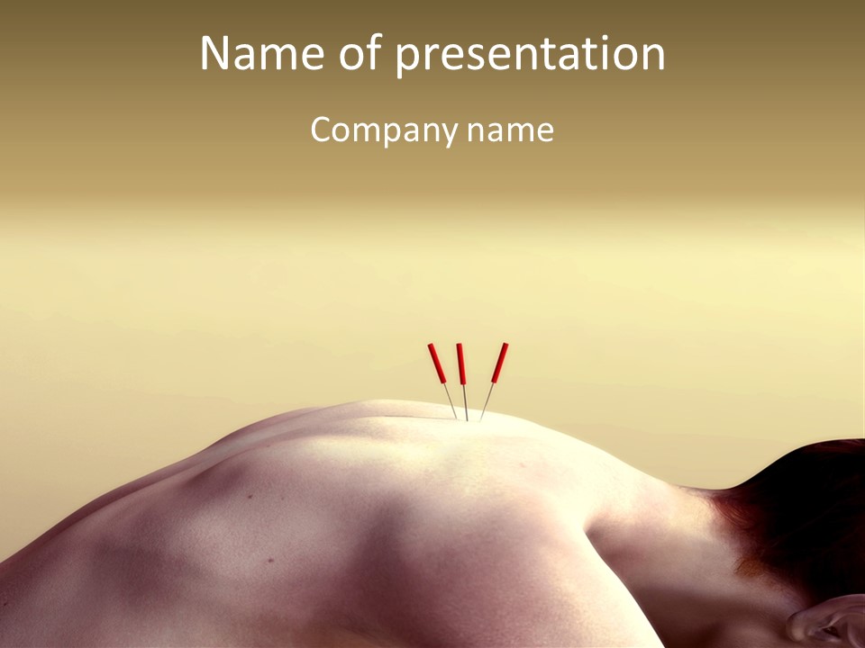 Woman Receiving Acupuncture PowerPoint Template