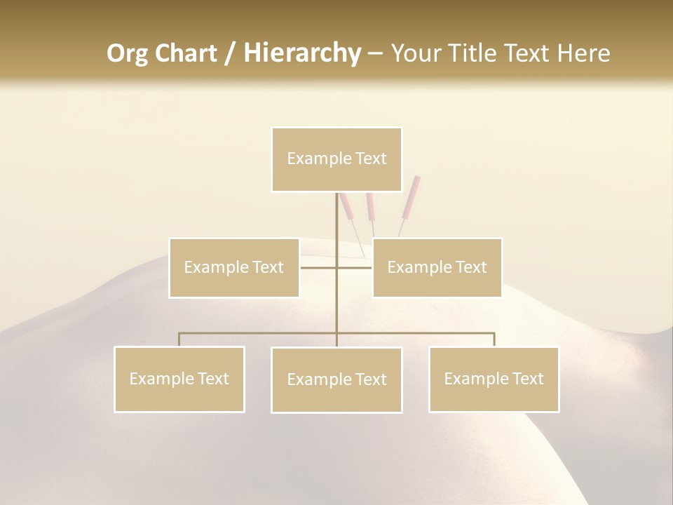 Woman Receiving Acupuncture PowerPoint Template