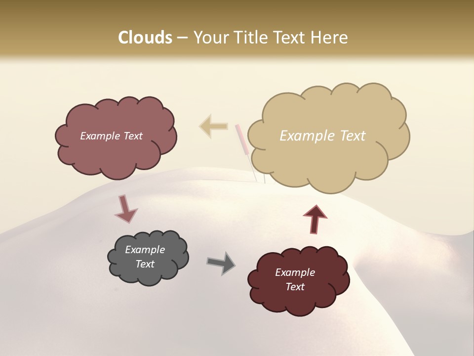 Woman Receiving Acupuncture PowerPoint Template