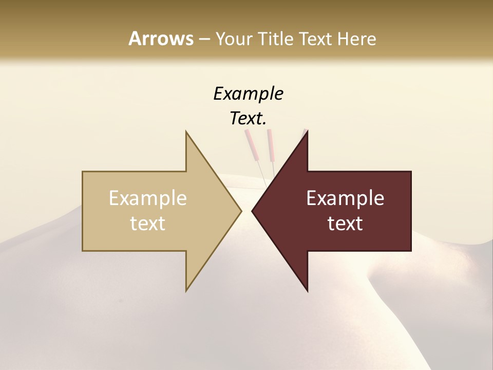 Woman Receiving Acupuncture PowerPoint Template