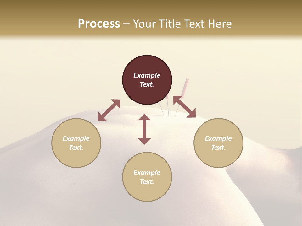 Woman Receiving Acupuncture PowerPoint Template