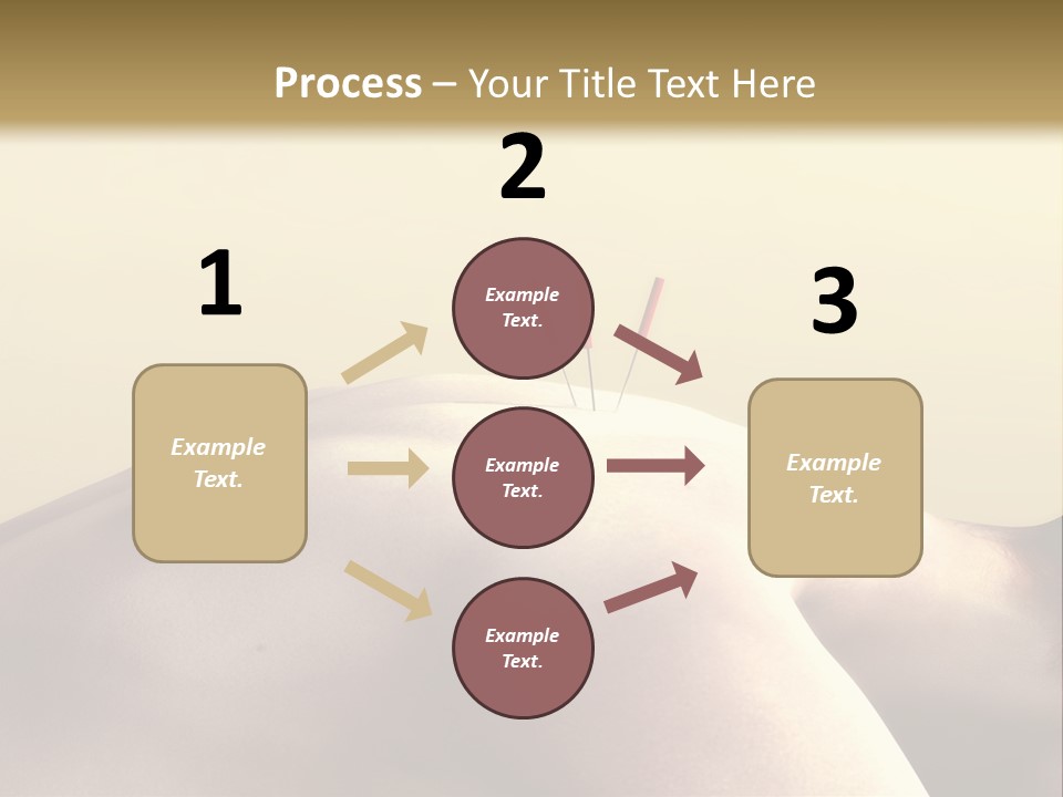 Woman Receiving Acupuncture PowerPoint Template