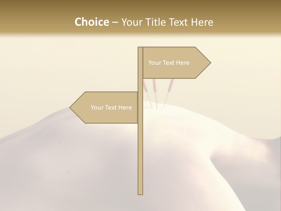 Woman Receiving Acupuncture PowerPoint Template