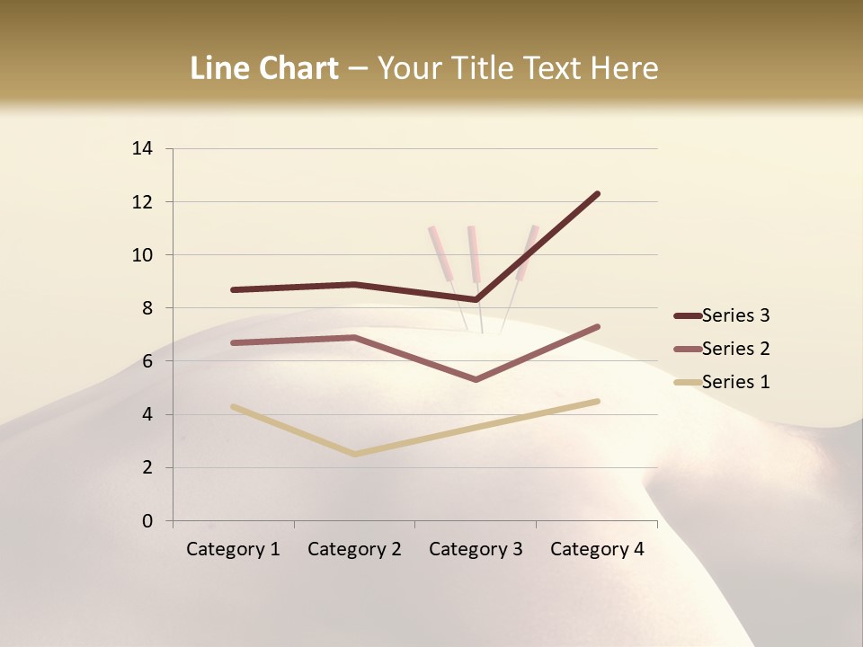 Woman Receiving Acupuncture PowerPoint Template