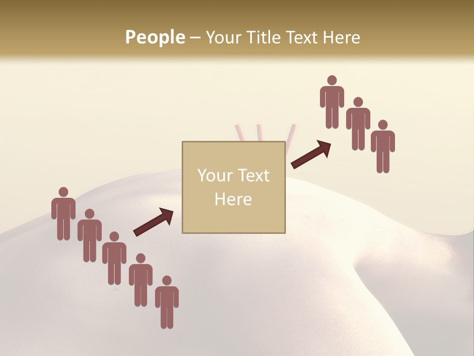 Woman Receiving Acupuncture PowerPoint Template