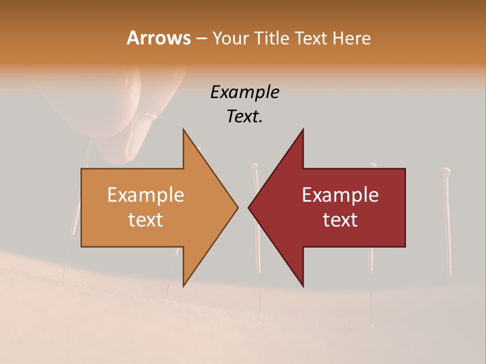 Acupuncture PowerPoint Template