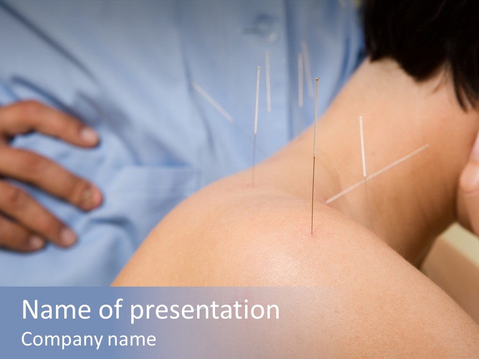 A Woman Getting Acupulations On Her Back With Needles PowerPoint Template