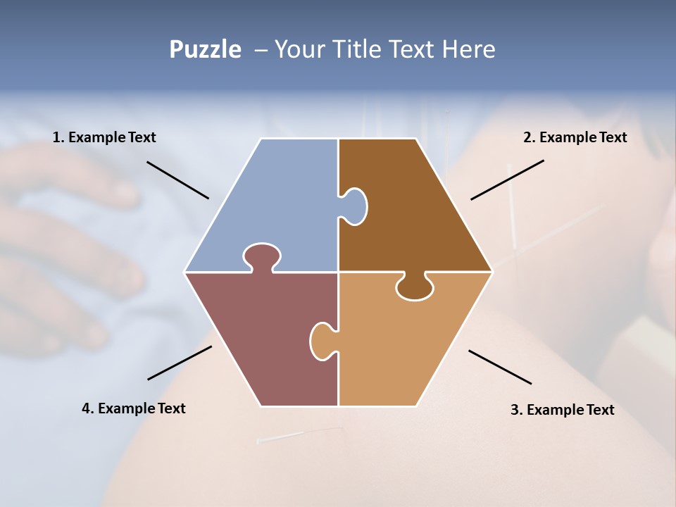 A Woman Getting Acupulations On Her Back With Needles PowerPoint Template