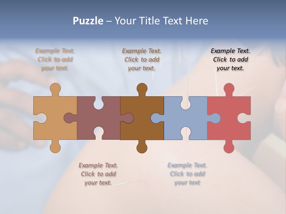 A Woman Getting Acupulations On Her Back With Needles PowerPoint Template