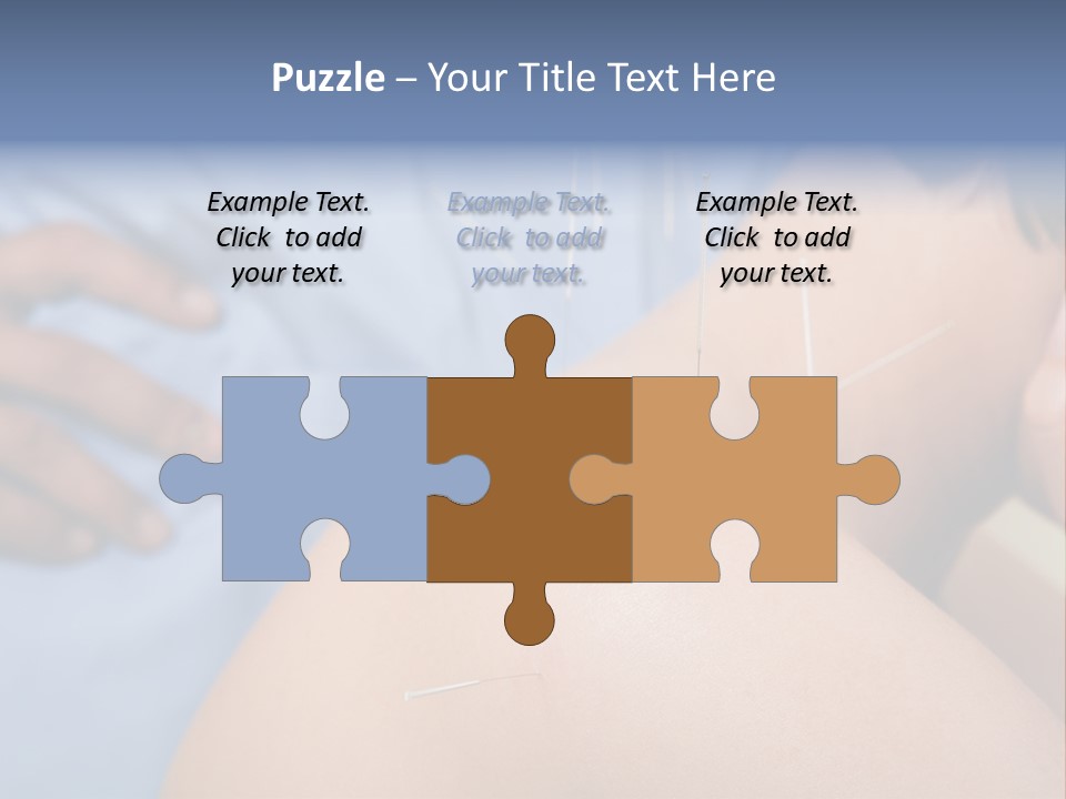 A Woman Getting Acupulations On Her Back With Needles PowerPoint Template