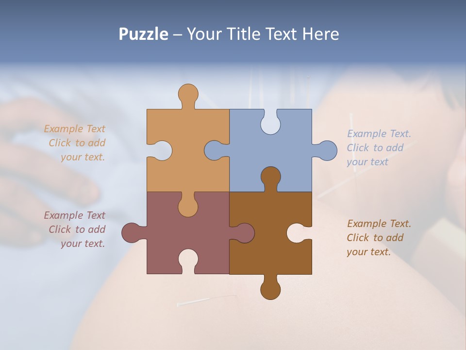 A Woman Getting Acupulations On Her Back With Needles PowerPoint Template