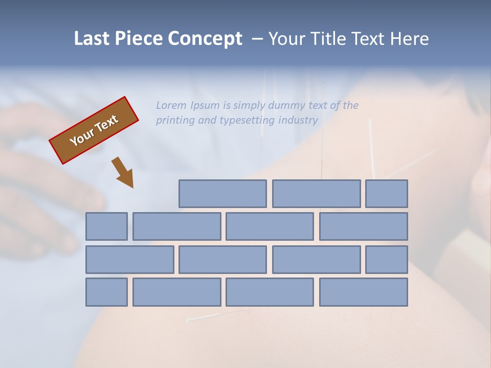 A Woman Getting Acupulations On Her Back With Needles PowerPoint Template