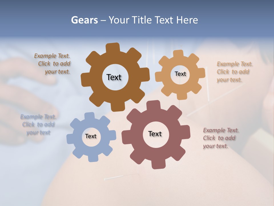 A Woman Getting Acupulations On Her Back With Needles PowerPoint Template