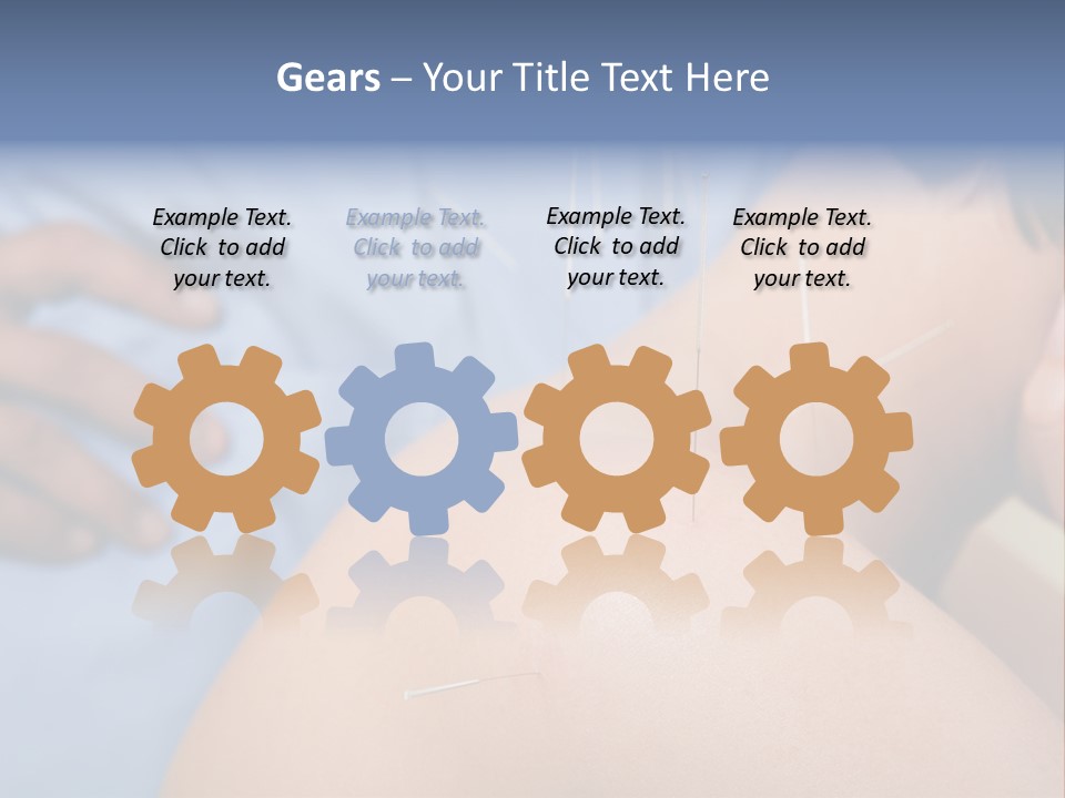 A Woman Getting Acupulations On Her Back With Needles PowerPoint Template