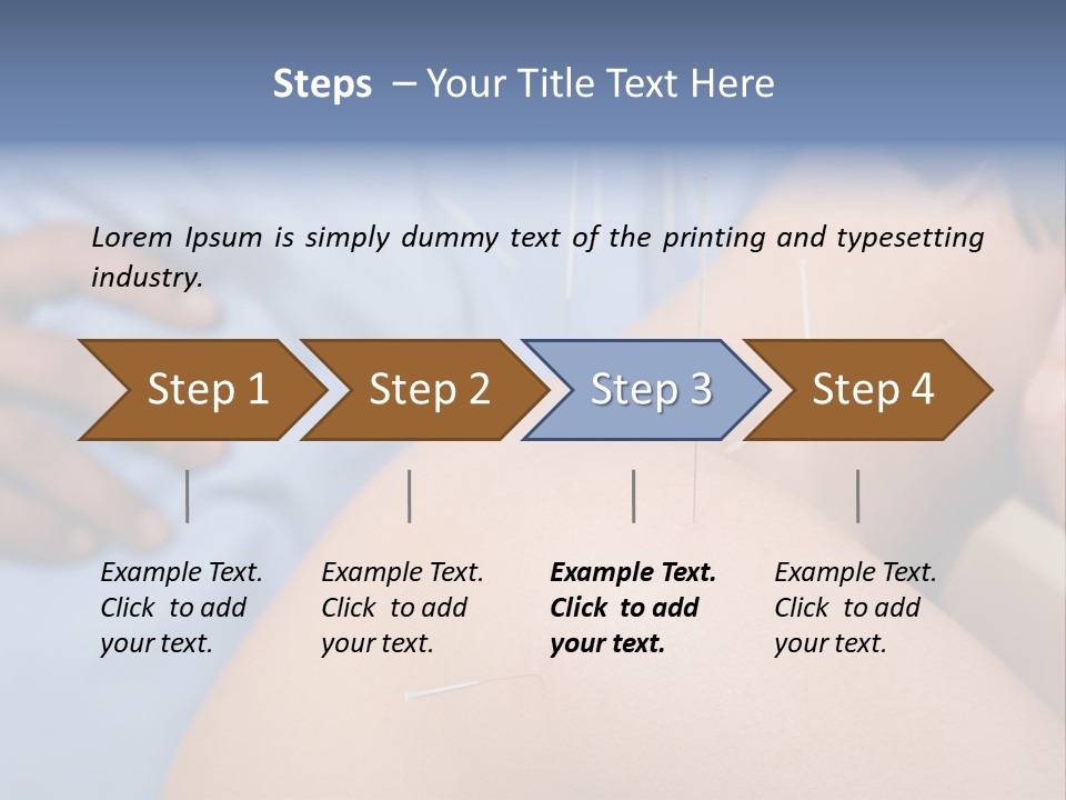 A Woman Getting Acupulations On Her Back With Needles PowerPoint Template