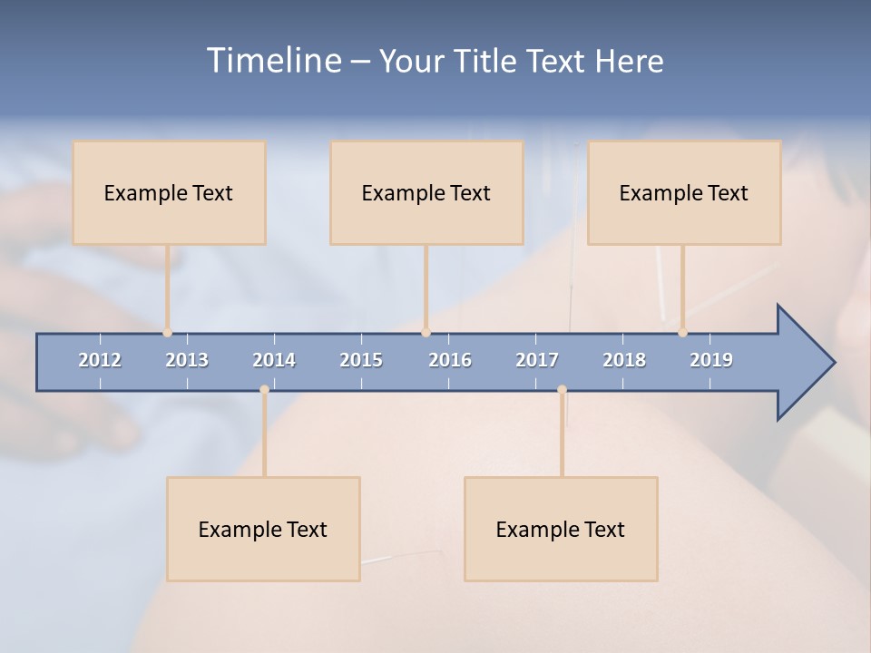A Woman Getting Acupulations On Her Back With Needles PowerPoint Template